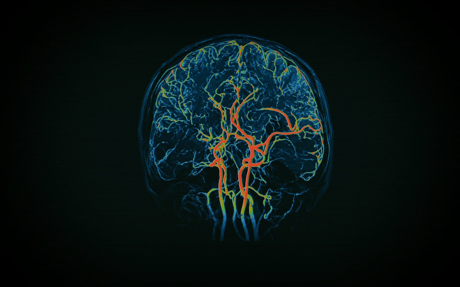 Neuroimaging Data